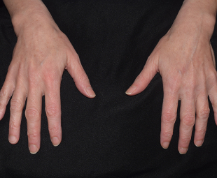 Aquagold After Result New York City